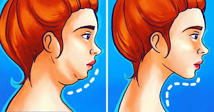 How to Get Rid of Chin Fat Reduce Double Chin Without Surgery