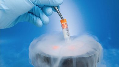 Photo of Frozen Embryo Transfer – Best IVF center in Jaipur
