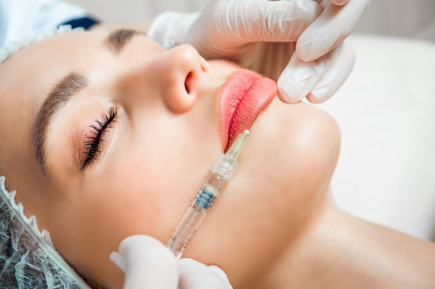lip fillers