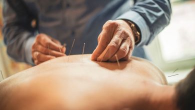 Photo of Does Acupuncture Work For Back Pain?