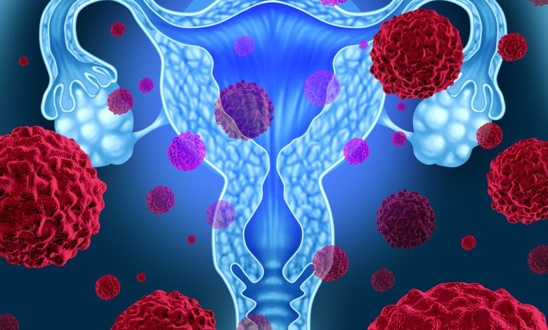 Uterine fibroids