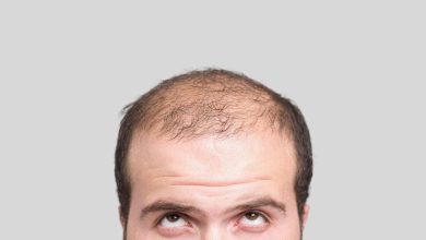 Photo of Means of diminishing going bald found in men