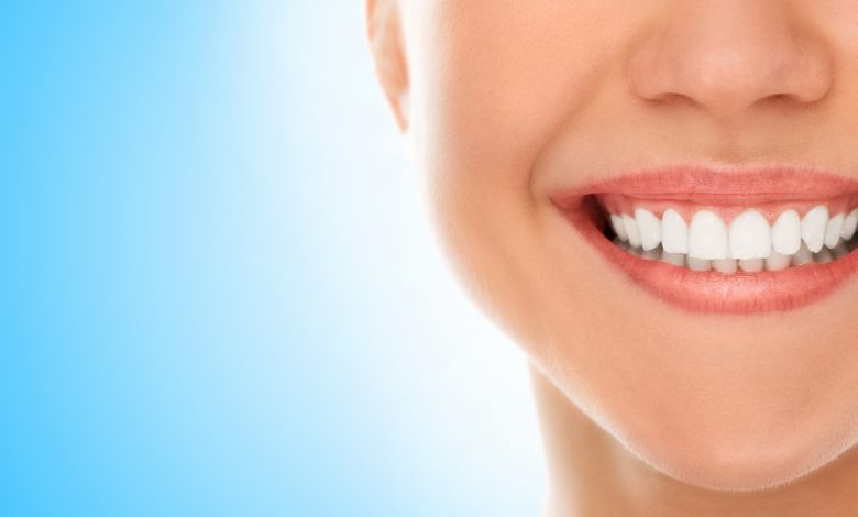 How Safe Are Dental Veneers in Adelaide