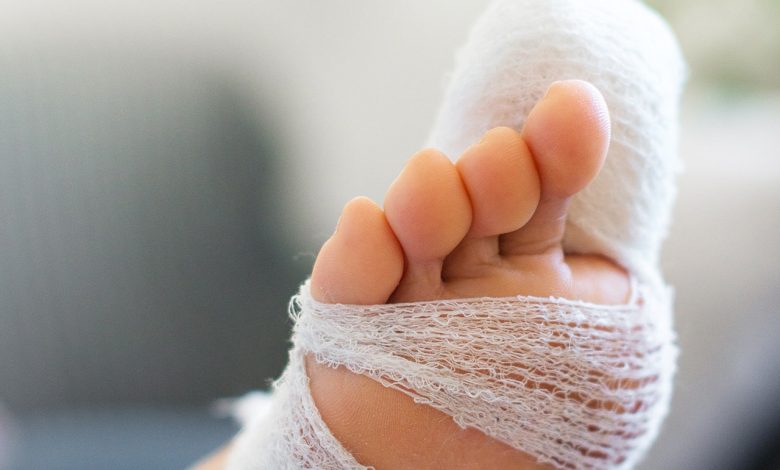 Broken Toe At Work Compensation