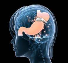 Hypno Gastric Band