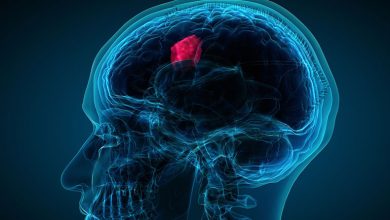 Photo of What are the signs and symptoms of a brain tumor?