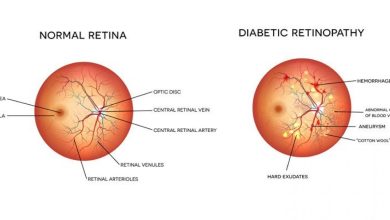 Photo of Diabetic Retinopathy: How to Prevent Vision Loss